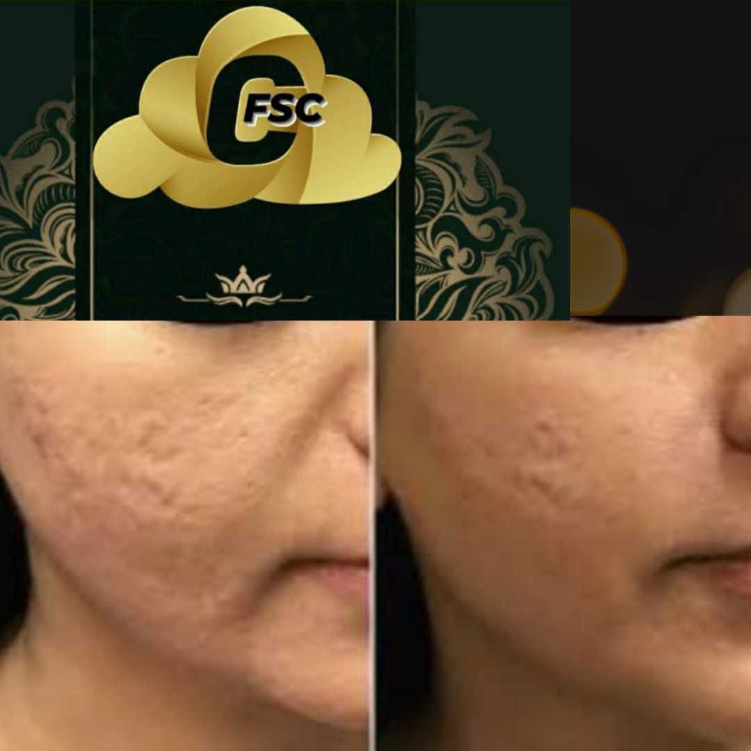 Before After Cosmetic Treatment
